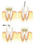 Root Canal Treatment Prices.jpg