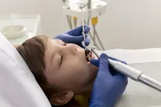 root canal treatment in children